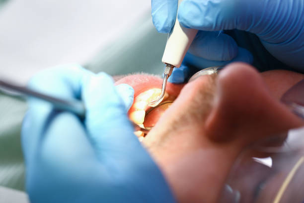 Best Emergency Dental Care for Broken or Chipped Teeth in Weatherly, PA
