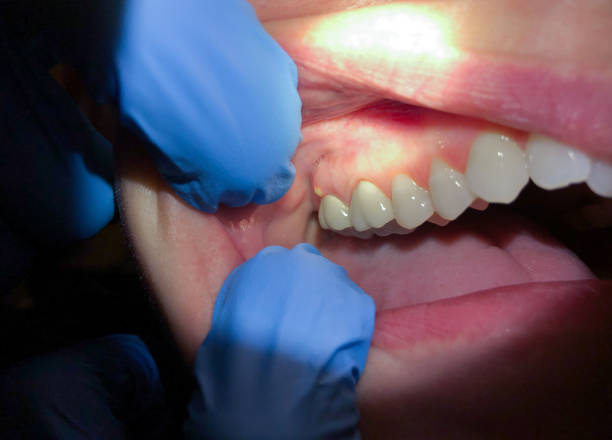 Best Emergency TMJ Treatment in Weatherly, PA